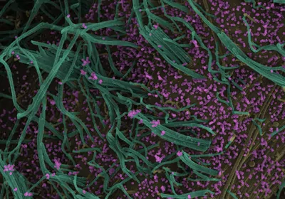 Micrograph of influenza A virus and RSV Micrograph of influenza A virus and RSV